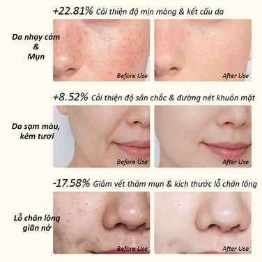 AURORA Photon Mask EM-02